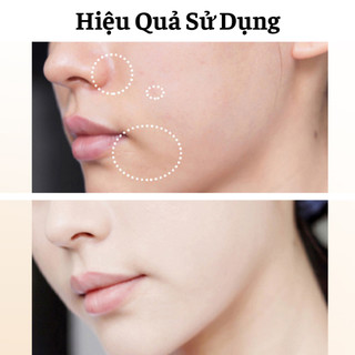 Bộ 10 Thanh Tinh Chất Vitamin Giúp Trắng Da Ngăn Ngừa Thâm Nám Tàn Nhang Sạm Da Xóa Mờ Các Nếp Nhăn Dưỡng Ẩm Sạch Mụn