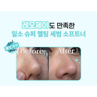 Tinh chất ủ mụn/Cây đẩy mụn ILSO