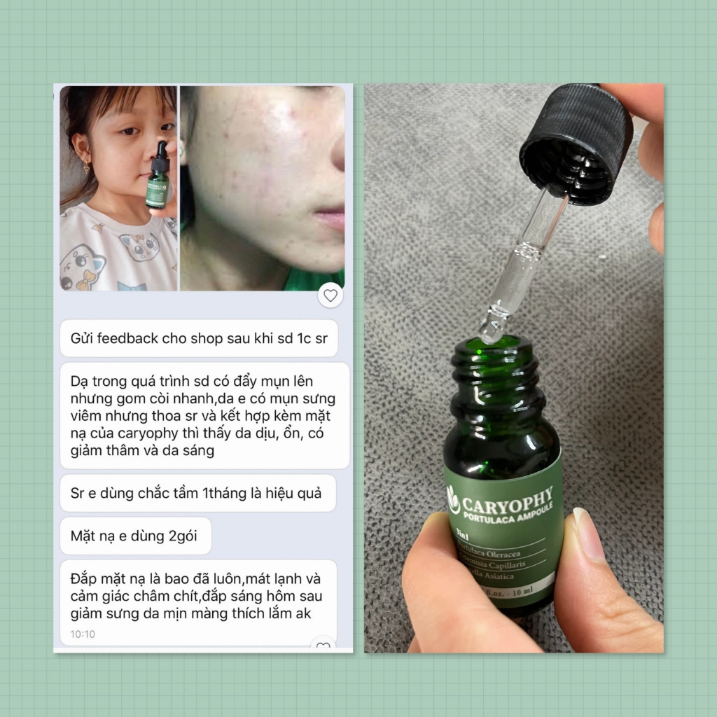 Ảnh Bộ chăm sóc da mụn Caryophy portulaca (serum 30ml toner 300ml) 4