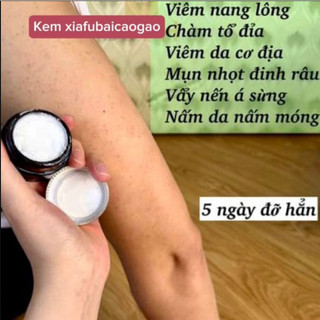Kem Bôi Viêm Da, Kem Bôi Đông Y Hắc Lào, Á Sừng, Vảy Nến, Chống Nấm Ngứa Đầu, Ghẻ Nước, Lang Ben, Vân Thỏ Beauty