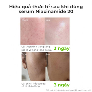 Serum dưỡng trắng PESTLO Rejurecipe Niacinamide 20% 30ml