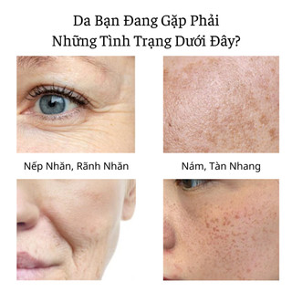 Kem Nhật Bản Hết Sạch Thâm Nám Tàn Nhang Xóa Nếp Nhăn Chống Lão Hóa Dưỡng Da Ẩm Mịn