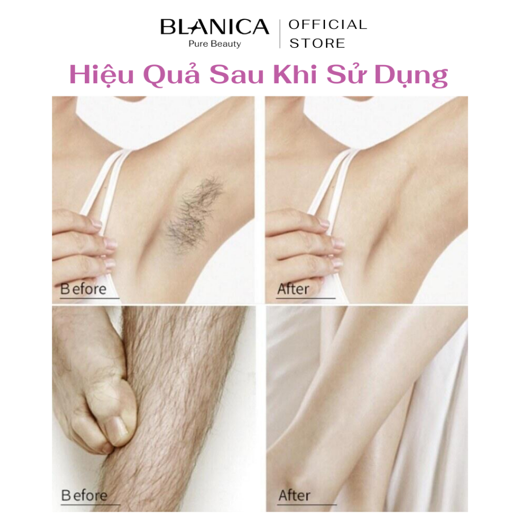 Ảnh Kem tẩy lông BLANICA Hair Removal Cream tẩy sạch lông vùng kín, tay, chân, nách an toàn, không đau rát 120g 4