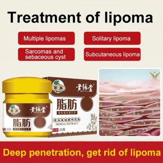 Kem Bôi Bướu Cổ Tuyến Giáp Lipoma, Kem Bôi U Bướu Mỡ Lipoma Cream 20gr, Không Đau Nhức, Hiệu Quả Cao, Vân Thỏ Beauty