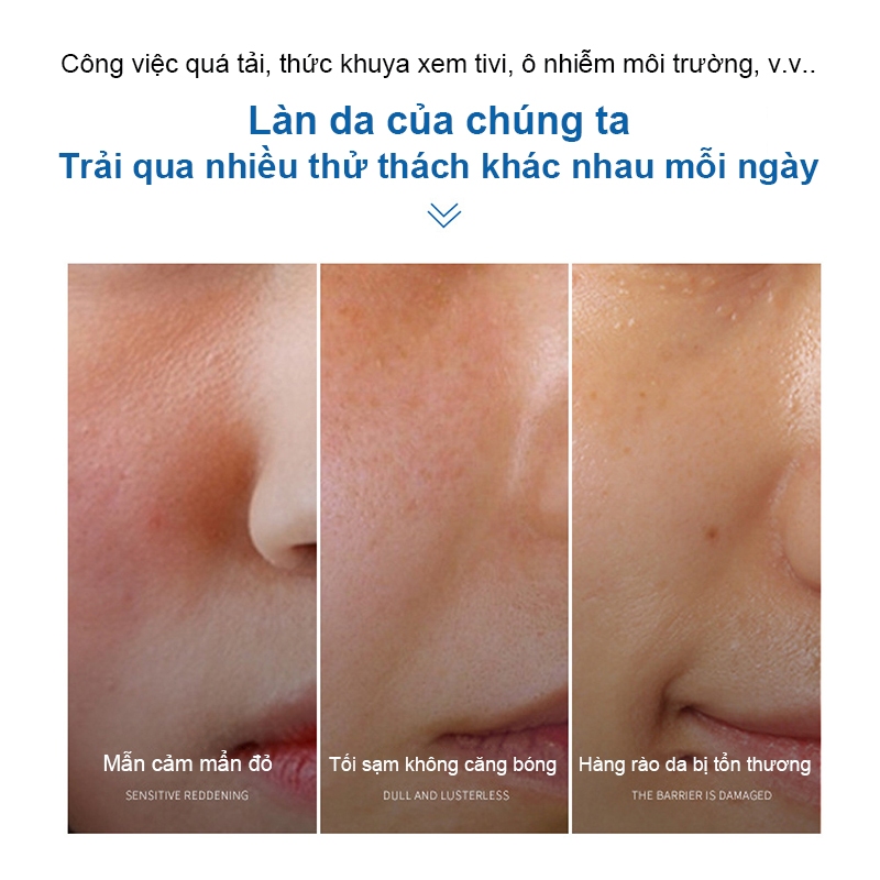 Kem phục hồi B5 Kem đỏ da mặt 40ml Da nhạy cảm làm mờ vết mụn phục hồi hàng rào bảo vệ da hư tổn