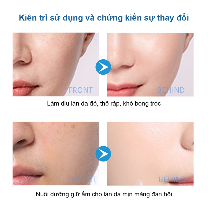 Kem phục hồi B5 Kem đỏ da mặt 40ml Da nhạy cảm làm mờ vết mụn phục hồi hàng rào bảo vệ da hư tổn