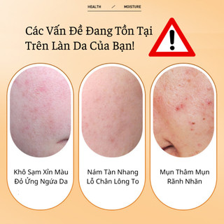 Xịt Khoáng Vitamin C Dưỡng Trắng Da Giữ Ẩm Da Ngậm Nước Se Khít Lỗ Chân Lông Loại Bỏ Nếp Nhăn Vết Thâm Nám Thâm Mụn