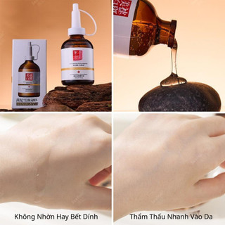 Serum Dưỡng Ẩm Trắng Da Xóa Sạch Thâm Nám Tàn Nhang Ngăn Ngừa Mụn Quay Trở Lại 50ml