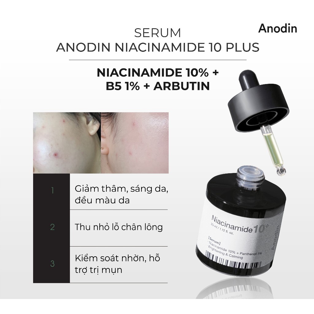 Tinh chất dưỡng sáng mờ thâm, giảm mụn kiểm soát dầu thừa ANODIN NIACINAMIDE 10 PLUS Serum 33ml