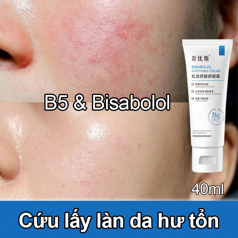 Kem phục hồi B5 Kem đỏ da mặt 40ml Da nhạy cảm làm mờ vết mụn phục hồi hàng rào bảo vệ da hư tổn