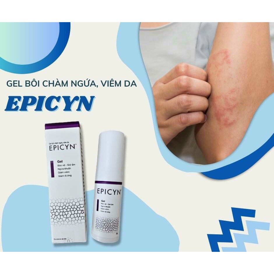 Thiết kế của Viêm Da Cơ Địa Chàm Tiêu Chuẩn