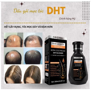COMBO 1 dầu gội + 1 serum mọc tóc DHT kích tóc mọc dài , dày , khoẻ hiệu quả