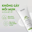 Kem Dưỡng Kiềm Dầu Babe Stop AKN Mattifying Moisturiser Cho Da Dầu Mụn 50ml Duduhouse