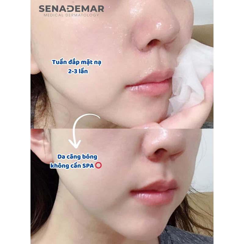 5-10 miếng Mặt nạ sena demar sodium DNA B5 mask  dưỡng trắng hd 2028 mặt nạ senademar  IS175