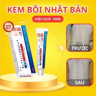 Kem Bôi Ngứa Da Nhật Bản 15g – Giảm Ngứa, Khô Da, Nứt Nẻ, Mẩn Đỏ, Thấm Nhanh Không Nhờn