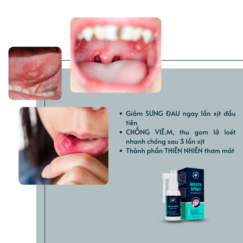 Ảnh Xịt Dứt Điểm Nhiệt Miệng, Nhiệt lưỡi, Lở môi, Viêm Lợi Dego Pharma - Dịu Cơn Đau Loét Miệng, Hết Hôi Miệng 3