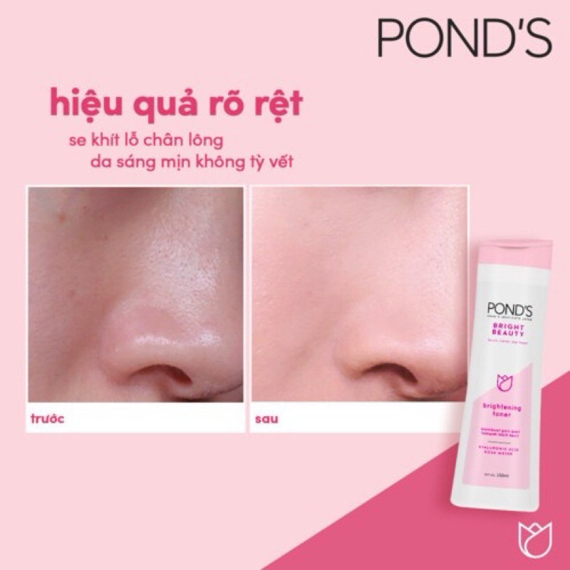 Nước Hoa Hồng Pond’s Sáng Da, Cân Bằng pH - 150ml