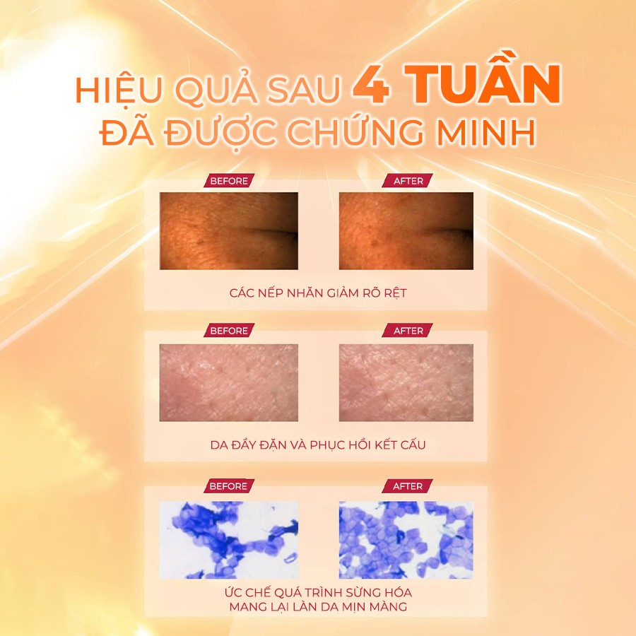 Ảnh Serum Niacinamide 15% Trắng Da Se Khít Lỗ Chân Lông Medi Shot NA15 MEISHOKU 30ml 4