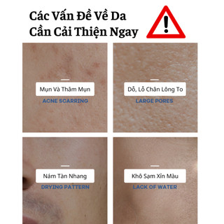Sữa Rửa Mặt Sạch Dầu Bụi Bẩn Giúp Da Trắng Mịn Đều Màu Se Khít Lỗ Chân Lông Ngăn Ngừa Mụn Quay Trở Lại