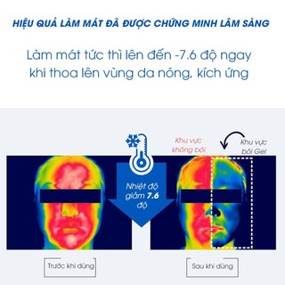 Gel làm dịu da hữu cơ cho bé ATONO2 Oxygen Soothing Gel làm dịu mát da khô nóng, da nhạy cảm 30g/160g