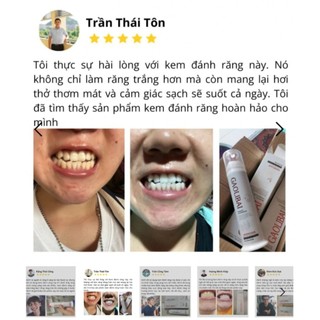 Kem Đánh Răng GAOLIBAI Nhật Bản, Gel Nano Bạc Làm Trắng Răng 120gr Sạch Mảng Bám, Hơi Thở Thơm Mát, Vân Thỏ Beauty