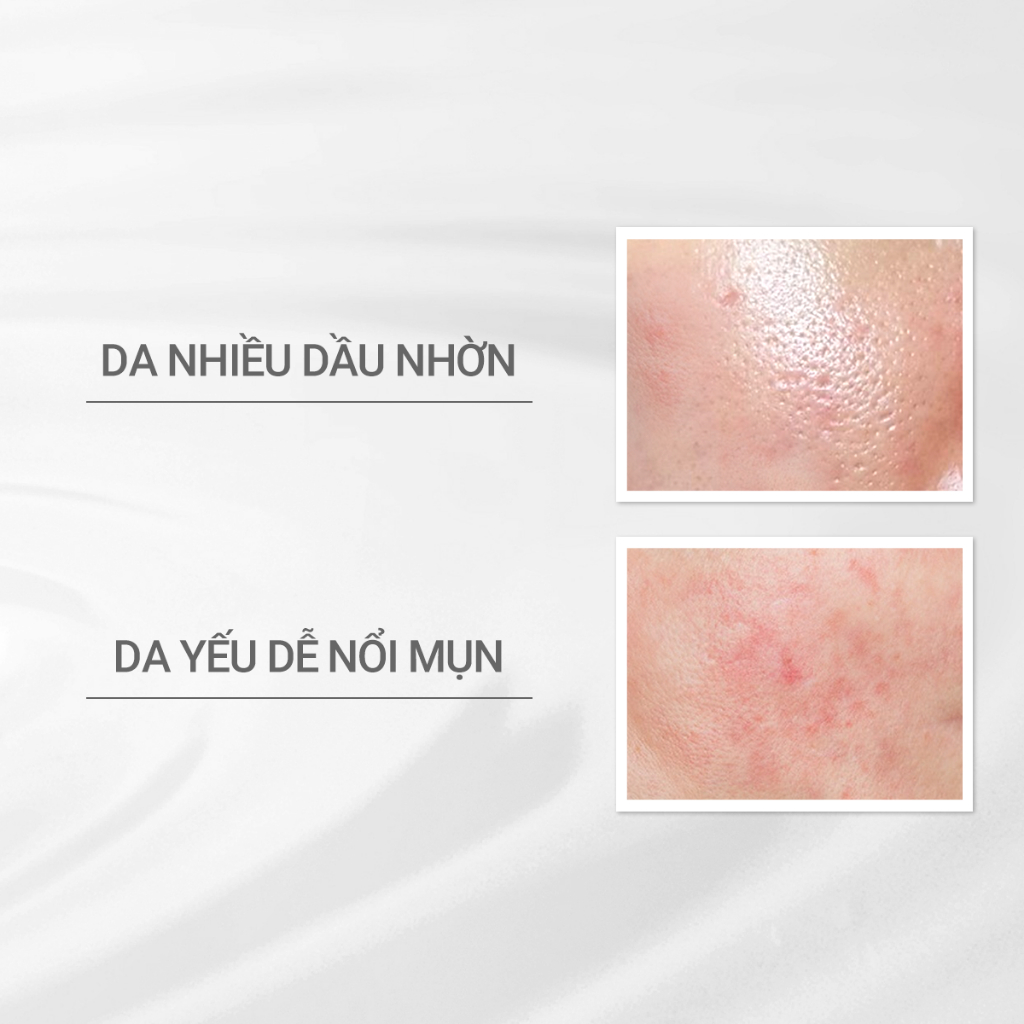 Ảnh Sữa dưỡng cho da dầu/hỗn hợp nhạy cảm Dprogram Microbiome Balance Care Emulsion 100ml 2