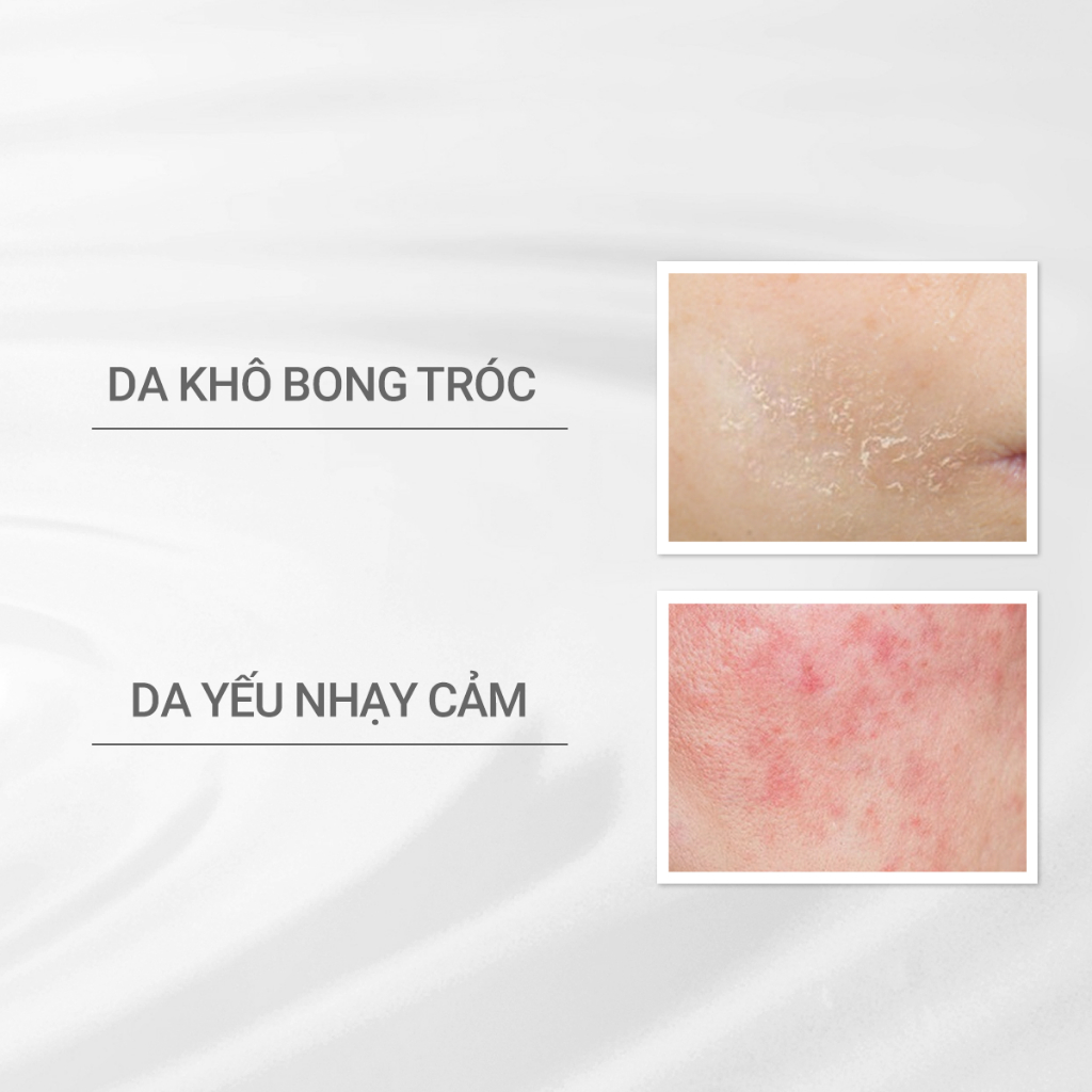 Ảnh Nước cân bằng cho da khô nhạy cảm Dprogram Microbiome Moist Care Lotion 125ml 3