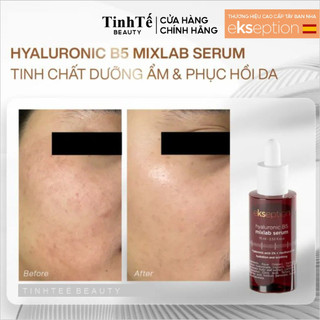 Tinh chất cấp ẩm phục hồi Ekseption Hyaluronic B5 Mixlab serum 75ml