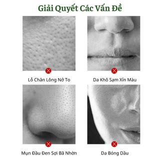 Mặt Nạ Lăn Trà Xanh Giúp Da Trắng Mịn Sạch Mụn Se Khít Lỗ Chân Lông Cân Bằng Ẩm Loại Bỏ Mụn Đầu Đen