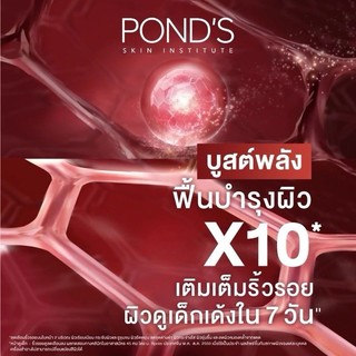 KEM DƯỠNG TRẮNG, CHỐNG LÃO HÓA CAO CẤP POND'S AGE MIRACLE ( Thái Lan )