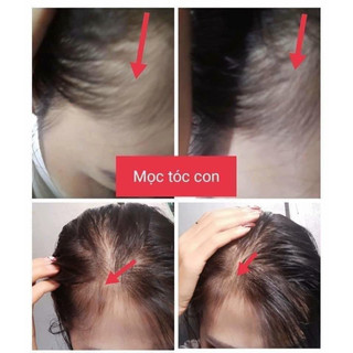 Xịt Kích Thích Mọc Tóc GENIVE Hair Tonic 120ml - Thái Lan