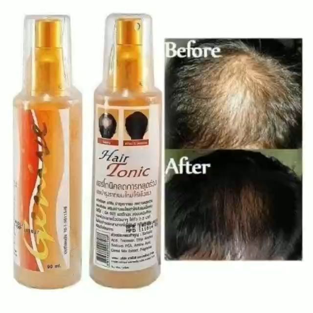 Xịt Kích Thích Mọc Tóc GENIVE Hair Tonic 120ml - Thái Lan