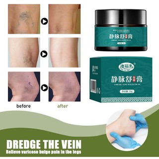 Kem Bôi Suy Dãn Tĩnh Mạch Nội Địa Trung, Kem Suy Giảm Tĩnh Mạch Giúp Giảm Đau, Thúc Đẩy Tuần Hoàn Máu, Vân Thỏ Beauty