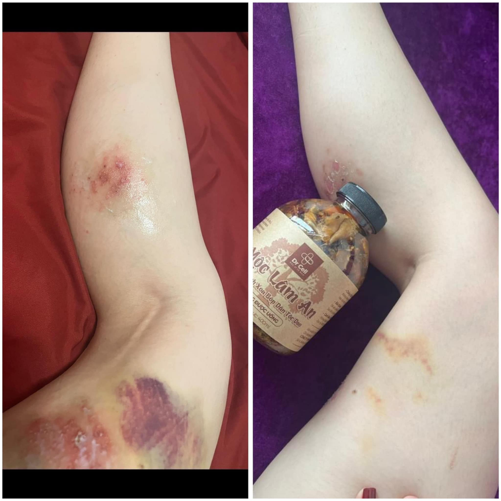 Dung Dịch Xoa Bóp Mộc Lâm An DrCell, Cải Thiện Đau Nhức Xương Khớp, Mùi Hương Đuổi Côn Trùng (400ml)