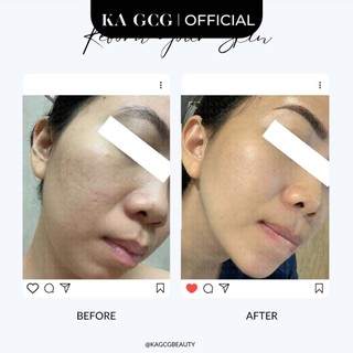 [Sale cận date] Bộ sản phẩm dưỡng da chống lão hóa, cải thiện nếp nhăn, săn chắc hiệu quả KA GCG