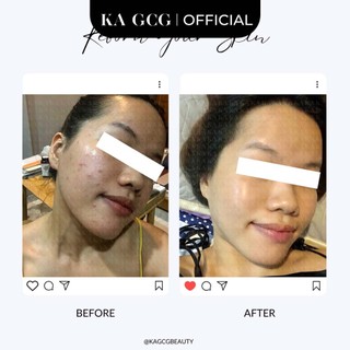 [Sale cận date] Bộ sản phẩm dưỡng da chống lão hóa, cải thiện nếp nhăn, săn chắc hiệu quả KA GCG