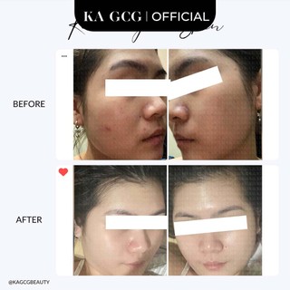 [Sale cận date] Bộ sản phẩm chăm sóc làm sáng, dưỡng trắng da giúp giảm thâm nám hiệu quả KA GCG