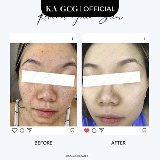 [Sale cận date] Bộ sản phẩm chăm sóc làm sáng, dưỡng trắng da giúp giảm thâm nám hiệu quả KA GCG