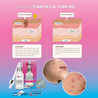 Combo 2 Serum Collagen Kihasu Cho Da Xỉn Màu Dưỡng Sáng, Cấp Ẩm, Làm Đều Màu Da