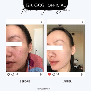 SNELO Kem Dưỡng Phục Hồi Da Ngày & Đêm 50ml | Cấp Ẩm, Ceramide, Snail, Niacinamide | KA GCG
