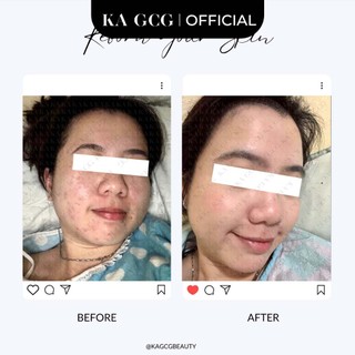 SNELO Kem Dưỡng Phục Hồi Da Ngày & Đêm 50ml | Cấp Ẩm, Ceramide, Snail, Niacinamide | KA GCG