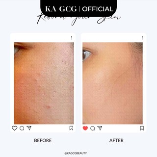 Sữa rửa mặt TRÀM dịu nhẹ giúp làm sạch sâu dành cho mọi loại da 100ML KA GCG