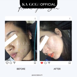 Sữa rửa mặt TRÀM dịu nhẹ giúp làm sạch sâu dành cho mọi loại da 100ML KA GCG
