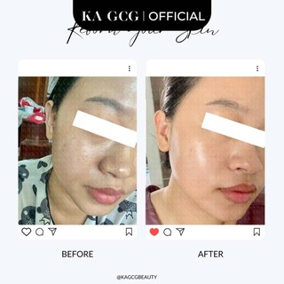 [Sale cận date] Kem dưỡng PRO ANTI AGING chống lão hóa giúp cải thiện nếp nhăn săn chắc 50ml KA GCG