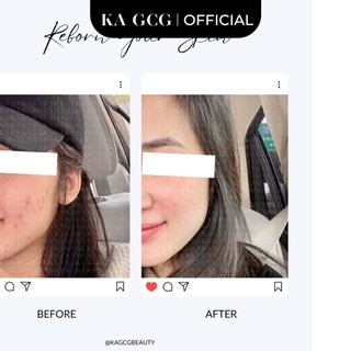 [Sale cận date] Kem chống nắng vật lý HYDRATING ANTIOXIDANT SPF 50 PA+++ 30ML - KA GCG