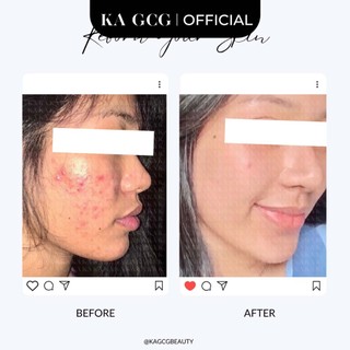 [Sale cận date] Tinh chất dưỡng ẩm GLOWING giúp nuôi dưỡng làn da căn bóng mịn màng 10ml/30ml KA GCG