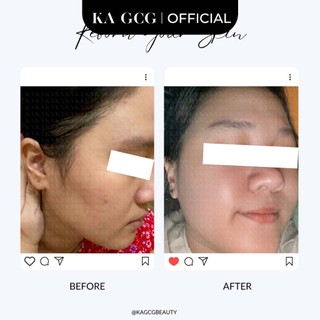 [Sale cận date] Tinh chất dưỡng trắng BRIGHTENING, làm sáng da tăng cường 30ml KA GCG