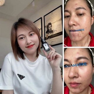 Combo serum cấp ẩm, làm sáng, đều màu da, hỗ trợ giảm thâm, sạm Aquamarine 20ml + mẫu kemdưỡng 5gram