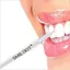 Máy Làm Trắng Răng SMILEKIT S5 Giúp Tẩy Trắng Răng Không Ê Buốt Chắc Khỏe Từ Sâu Bên Trong Hiểu Quả