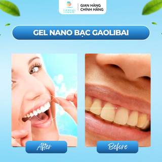Gel Nano Bạc Gaolibai Đánh Bật Cao Răng, Sạch Mảng Bám, Trắng Răng, Giảm Hôi Miệng, Thơm Mát Hiệu Quả 120g